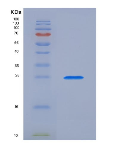 SDS-PAGE analysis of Mouse Rln1 (Prorelaxin 1) - Recombinant Protein, CAT# BLT-07217P, showing >90% purity under 15% SDS-PAGE (Reduced)Mouse Rln1 (Prorelaxin 1) - Recombinant Protein