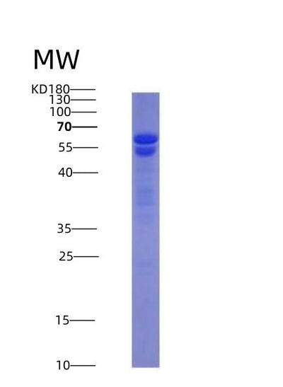 SDS-PAGE analysis of Human NUMA1 (Nuclear Mitotic Apparatus Protein 1) - Recombinant Protein, CAT# BLT-07218P, showing >95% purity under 15% SDS-PAGE (Reduced)Human NUMA1 (Nuclear Mitotic Apparatus Protein 1) - Recombinant Protein