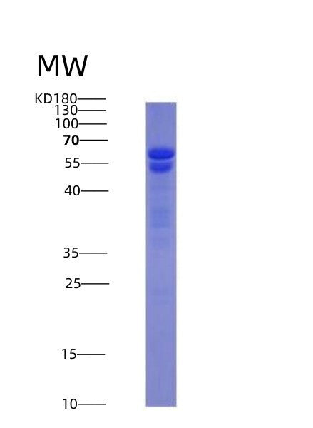 SDS-PAGE analysis of Human NUMA1 (Nuclear Mitotic Apparatus Protein 1) - Recombinant Protein, CATHuman NUMA1 (Nuclear Mitotic Apparatus Protein 1) - Recombinant Protein