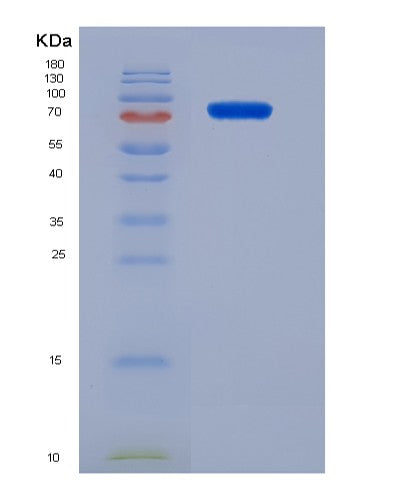 SDS-PAGE analysis of Human KDR (Vascular Endothelial Growth Factor Receptor 2) - Recombinant Protein, CATHuman KDR (Vascular Endothelial Growth Factor Receptor 2) - Recombinant Protein