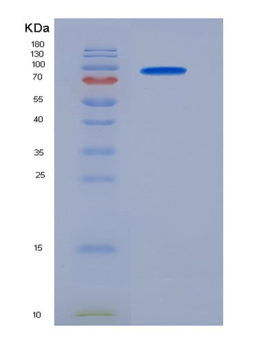 SDS-PAGE analysis of Human MME (Neprilysin) - Recombinant Protein, CAT# BLT-05983P, showing >95% purity under 15% SDS-PAGE (Reduced)Human MME (Neprilysin) - Recombinant Protein