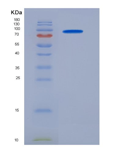 SDS-PAGE analysis of Human MME (Neprilysin) - Recombinant Protein, CATHuman MME (Neprilysin) - Recombinant Protein