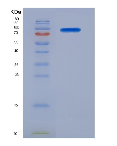 SDS-PAGE analysis of Human NCAM1 (Neural Cell Adhesion Molecule 1) - Recombinant Protein, CATHuman NCAM1 (Neural Cell Adhesion Molecule 1) - Recombinant Protein