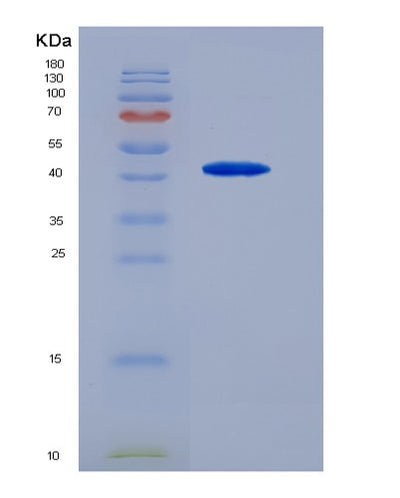 SDS-PAGE analysis of Human TNFRSF11B (Tumor Necrosis Factor Receptor Superfamily Member 11B) - Recombinant Protein, CAT# BLT-04535P, showing >95% purity under 15% SDS-PAGE (Reduced)Human TNFRSF11B (Tumor Necrosis Factor Receptor Superfamily Member 11B) - Recombinant Protein