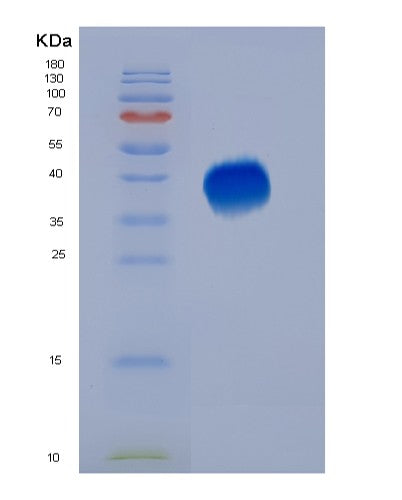 SDS-PAGE analysis of Human PDCD1 (Programmed Cell Death Protein 1) - Recombinant Protein, CATHuman PDCD1 (Programmed Cell Death Protein 1) - Recombinant Protein