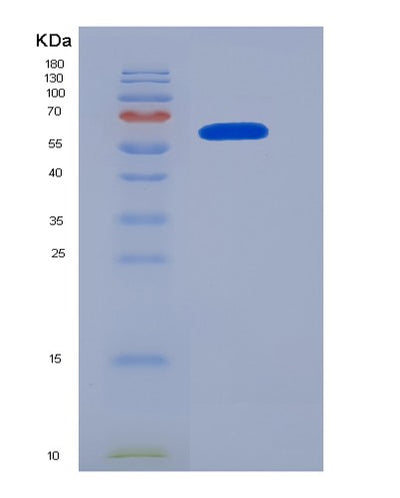 SDS-PAGE analysis of Human NRP1 (Neuropilin-1) - Recombinant Protein, CAT# BLT-05182P, showing >95% purity under 15% SDS-PAGE (Reduced)Human NRP1 (Neuropilin-1) - Recombinant Protein