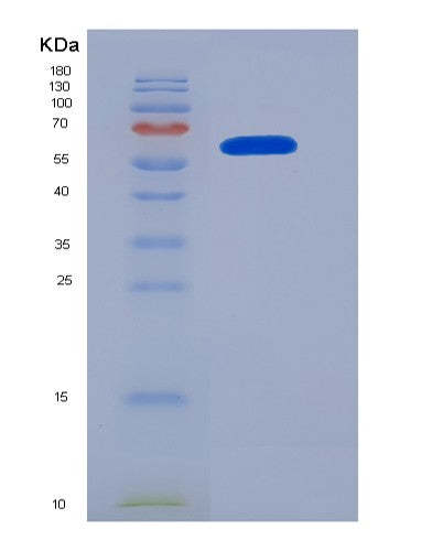 SDS-PAGE analysis of Human NRP1 (Neuropilin-1) - Recombinant Protein, CATHuman NRP1 (Neuropilin-1) - Recombinant Protein