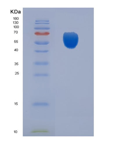 SDS-PAGE analysis of Human CDC123 (Translation Initiation Factor Eif2 Assembly Protein) - Recombinant Protein, CAT# BLT-05959P, showing >90% purity under 15% SDS-PAGE (Reduced)Human CDC123 (Translation Initiation Factor Eif2 Assembly Protein) - Recombinant Protein