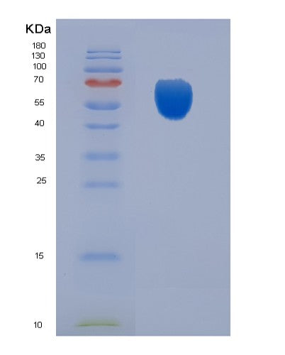 SDS-PAGE analysis of Human CDC123 (Translation Initiation Factor Eif2 Assembly Protein) - Recombinant Protein, CATHuman CDC123 (Translation Initiation Factor Eif2 Assembly Protein) - Recombinant Protein