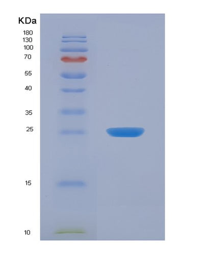 SDS-PAGE analysis of Human FIBP (Acidic Fibroblast Growth Factor Intracellular-Binding Protein) - Recombinant Protein, CAT# BLT-04854P, showing >95% purity under 15% SDS-PAGE (Reduced)Human FIBP (Acidic Fibroblast Growth Factor Intracellular-Binding Protein) - Recombinant Protein