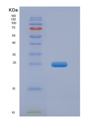 SDS-PAGE analysis of Human FGF19 (Fibroblast Growth Factor 19) - Recombinant Protein, CAT# BLT-04284P, showing >95% purity under 15% SDS-PAGE (Reduced)Human FGF19 (Fibroblast Growth Factor 19) - Recombinant Protein