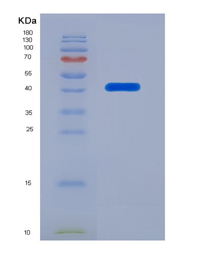SDS-PAGE analysis of Human TNFSF13B (Tumor Necrosis Factor Ligand Superfamily Member 13B) - Recombinant Protein, CATHuman TNFSF13B (Tumor Necrosis Factor Ligand Superfamily Member 13B) - Recombinant Protein
