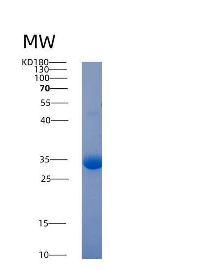 SDS-PAGE analysis of Human TGFBR1 (Tgf-Beta Receptor Type-1) - Recombinant Protein, CAT# BLT-07219P, showing >90% purity under 15% SDS-PAGE (Reduced)Human TGFBR1 (Tgf-Beta Receptor Type-1) - Recombinant Protein