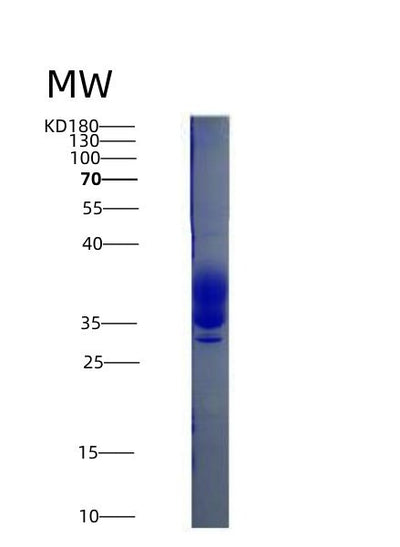 SDS-PAGE analysis of Mouse Csf1 (Macrophage Colony-Stimulating Factor 1) - Recombinant Protein, CAT# BLT-04677P, showing >90% purity under 15% SDS-PAGE (Reduced)Mouse Csf1 (Macrophage Colony-Stimulating Factor 1) - Recombinant Protein