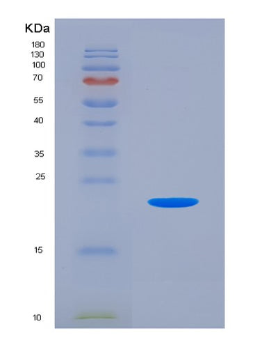 SDS-PAGE analysis of Mouse Csf2 (Granulocyte-Macrophage Colony-Stimulating Factor) - Recombinant Protein, CAT# BLT-04524P, showing >90% purity under 15% SDS-PAGE (Reduced)Mouse Csf2 (Granulocyte-Macrophage Colony-Stimulating Factor) - Recombinant Protein