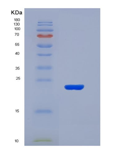 SDS-PAGE analysis of Mouse Il2 (Interleukin-2) - Recombinant Protein, CAT# BLT-04433P, showing >90% purity under 15% SDS-PAGE (Reduced)Mouse Il2 (Interleukin-2) - Recombinant Protein