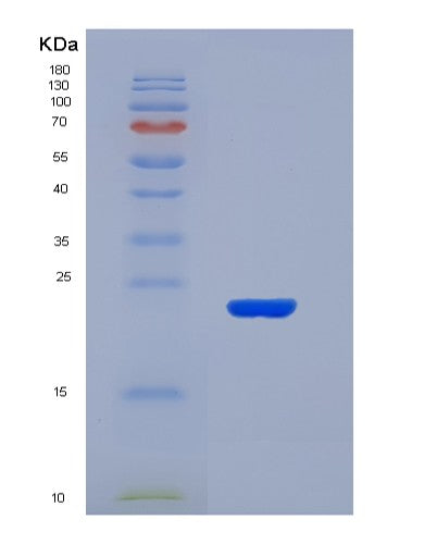 SDS-PAGE analysis of Mouse Il2 (Interleukin-2) - Recombinant Protein, CATMouse Il2 (Interleukin-2) - Recombinant Protein