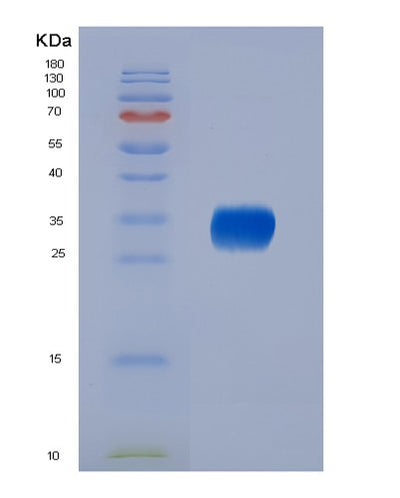 SDS-PAGE analysis of Mouse Il6 (Interleukin-6) - Recombinant Protein, CAT# BLT-04653P, showing >95% purity under 15% SDS-PAGE (Reduced)Mouse Il6 (Interleukin-6) - Recombinant Protein