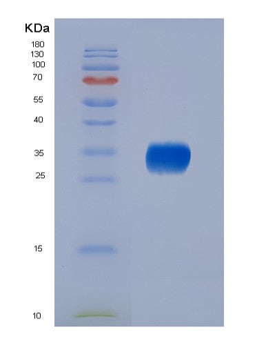 SDS-PAGE analysis of Mouse Il6 (Interleukin-6) - Recombinant Protein, CATMouse Il6 (Interleukin-6) - Recombinant Protein