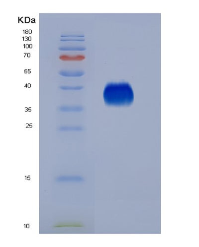 SDS-PAGE analysis of Mouse Il9 (Interleukin-9) - Recombinant Protein, CAT# BLT-04571P, showing >95% purity under 15% SDS-PAGE (Reduced)Mouse Il9 (Interleukin-9) - Recombinant Protein