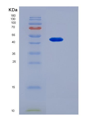 SDS-PAGE analysis of Mouse Tnfrsf1b (Tumor Necrosis Factor Receptor Superfamily Member 1B) - Recombinant Protein, CATMouse Tnfrsf1b (Tumor Necrosis Factor Receptor Superfamily Member 1B) - Recombinant Protein