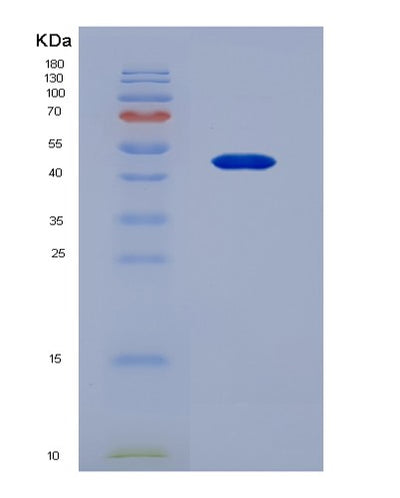 SDS-PAGE analysis of Human LBP (Lipopolysaccharide-Binding Protein) - Recombinant Protein, CAT# BLT-07220P, showing >95% purity under 15% SDS-PAGE (Reduced)Human LBP (Lipopolysaccharide-Binding Protein) - Recombinant Protein