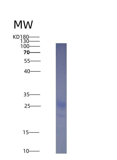 SDS-PAGE analysis of Mouse Tnfsf4 (Tumor Necrosis Factor Ligand Superfamily Member 4) - Recombinant Protein, CAT# BLT-04187P, showing >95% purity under 15% SDS-PAGE (Reduced)Mouse Tnfsf4 (Tumor Necrosis Factor Ligand Superfamily Member 4) - Recombinant Protein