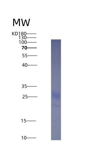 SDS-PAGE analysis of Mouse Tnfsf4 (Tumor Necrosis Factor Ligand Superfamily Member 4) - Recombinant Protein, CATMouse Tnfsf4 (Tumor Necrosis Factor Ligand Superfamily Member 4) - Recombinant Protein