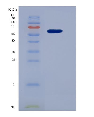 SDS-PAGE analysis of Human ACE (Angiotensin-Converting Enzyme) - Recombinant Protein, CAT# BLT-07221P, showing >95% purity under 15% SDS-PAGE (Reduced)Human ACE (Angiotensin-Converting Enzyme) - Recombinant Protein