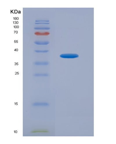 SDS-PAGE analysis of Human CD274 (Programmed Cell Death 1 Ligand 1) - Recombinant Protein, CAT# BLT-03561P, showing >95% purity under 15% SDS-PAGE (Reduced)Human CD274 (Programmed Cell Death 1 Ligand 1) - Recombinant Protein