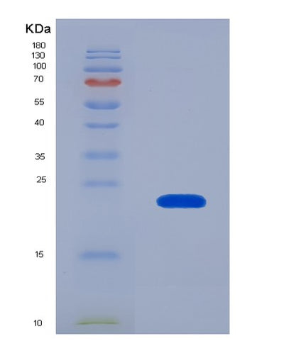 SDS-PAGE analysis of Human IL22 (Interleukin-22) - Recombinant Protein, CAT# BLT-04164P, showing >95% purity under 15% SDS-PAGE (Reduced)Human IL22 (Interleukin-22) - Recombinant Protein