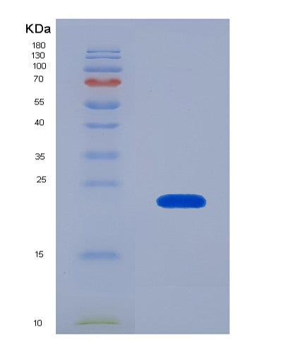 SDS-PAGE analysis of Human IL22 (Interleukin-22) - Recombinant Protein, CATHuman IL22 (Interleukin-22) - Recombinant Protein