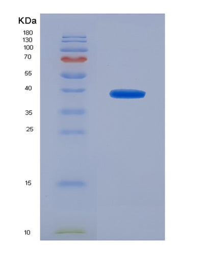 SDS-PAGE analysis of Human TREM1 (Triggering Receptor Expressed On Myeloid Cells 1) - Recombinant Protein, CAT# BLT-04567P, showing >95% purity under 15% SDS-PAGE (Reduced)Human TREM1 (Triggering Receptor Expressed On Myeloid Cells 1) - Recombinant Protein