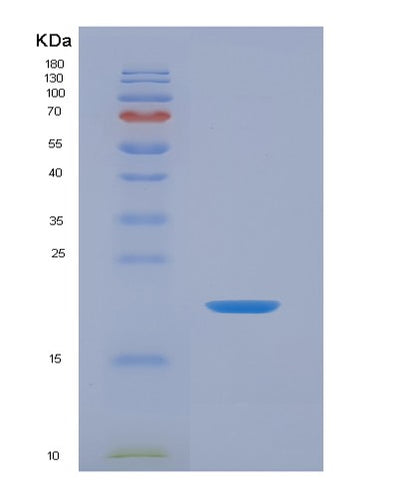 SDS-PAGE analysis of Human IL36G (Interleukin-36 Gamma) - Recombinant Protein, CAT# BLT-04695P, showing >90% purity under 15% SDS-PAGE (Reduced)Human IL36G (Interleukin-36 Gamma) - Recombinant Protein