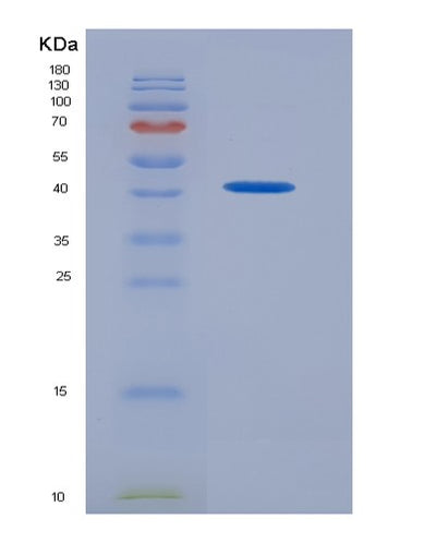 SDS-PAGE analysis of Human SKP2 (S-Phase Kinase-Associated Protein 2) - Recombinant Protein, CAT# BLT-07224P, showing >90% purity under 15% SDS-PAGE (Reduced)Human SKP2 (S-Phase Kinase-Associated Protein 2) - Recombinant Protein