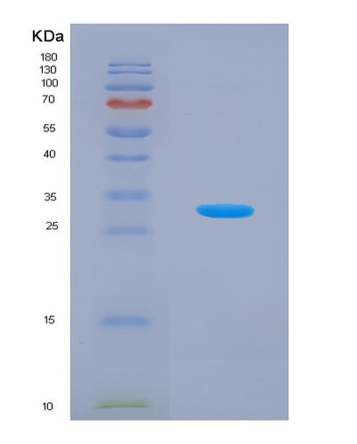 SDS-PAGE analysis of Human Adenosine Monophosphate Deaminase 2 (AMPD2) - Recombinant Protein, CAT# BLT-07225P, showing >90% purity under 15% SDS-PAGE (Reduced)Human Adenosine Monophosphate Deaminase 2 (AMPD2) - Recombinant Protein