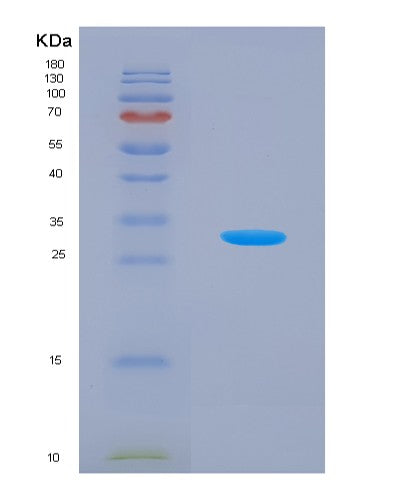 SDS-PAGE analysis of Human Adenosine Monophosphate Deaminase 2 (AMPD2) - Recombinant Protein, CATHuman Adenosine Monophosphate Deaminase 2 (AMPD2) - Recombinant Protein