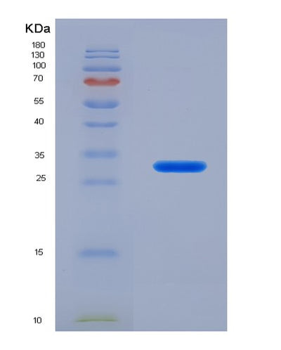 SDS-PAGE analysis of Human ADCY5 (Adenylate Cyclase Type 5) - Recombinant Protein, CAT# BLT-07226P, showing >90% purity under 15% SDS-PAGE (Reduced)Human ADCY5 (Adenylate Cyclase Type 5) - Recombinant Protein