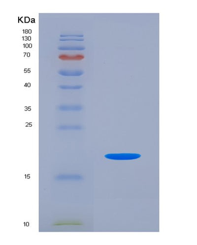 SDS-PAGE analysis of Human CALCA (Calcitonin) - Recombinant Protein, CAT# BLT-07227P, showing >90% purity under 15% SDS-PAGE (Reduced)Human CALCA (Calcitonin) - Recombinant Protein