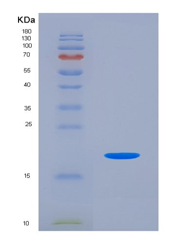 SDS-PAGE analysis of Human CALCA (Calcitonin) - Recombinant Protein, CATHuman CALCA (Calcitonin) - Recombinant Protein