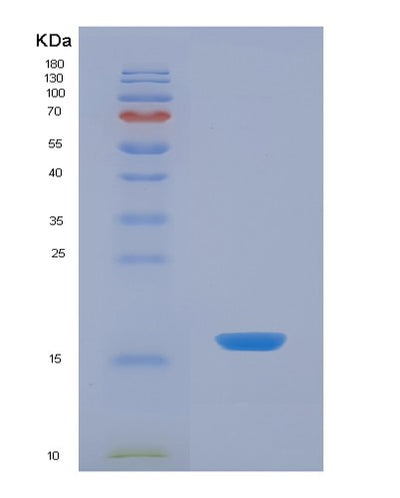 SDS-PAGE analysis of Human LIPE (Hormone-Sensitive Lipase) - Recombinant Protein, CAT# BLT-07235P, showing >90% purity under 15% SDS-PAGE (Reduced)Human LIPE (Hormone-Sensitive Lipase) - Recombinant Protein