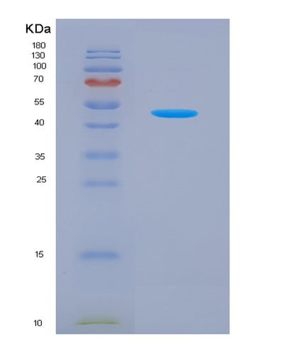SDS-PAGE analysis of Mouse Il21 (Interleukin-21) - Recombinant Protein, CAT# BLT-04619P, showing >85% purity under 15% SDS-PAGE (Reduced)Mouse Il21 (Interleukin-21) - Recombinant Protein