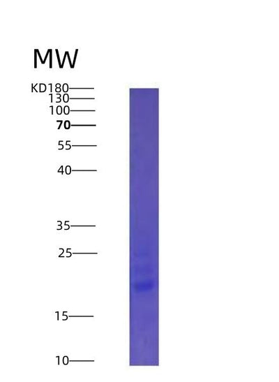 SDS-PAGE analysis of Human IL25 (Interleukin-25) - Recombinant Protein, CAT# BLT-04165P, showing >90% purity under 15% SDS-PAGE (Reduced)Human IL25 (Interleukin-25) - Recombinant Protein