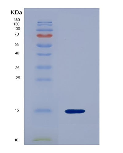 SDS-PAGE analysis of Human P2RY14 (P2Y Purinoceptor 14) - Recombinant Protein, CAT# BLT-07238P, showing >90% purity under 15% SDS-PAGE (Reduced)Human P2RY14 (P2Y Purinoceptor 14) - Recombinant Protein