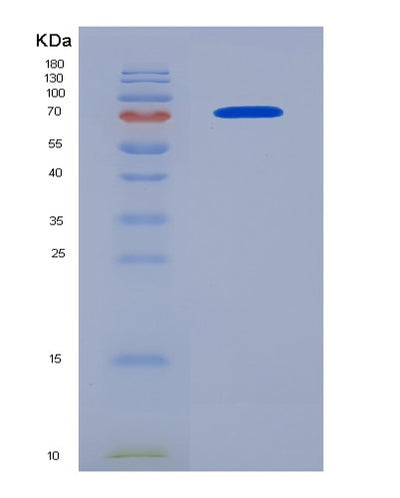 SDS-PAGE analysis of Human SERPINE1 (Plasminogen Activator Inhibitor 1) - Recombinant Protein, CAT# BLT-08447P showing >90% purity under 15% SDS-PAGE (Reduced)Human SERPINE1 (Plasminogen Activator Inhibitor 1) - Recombinant Protein