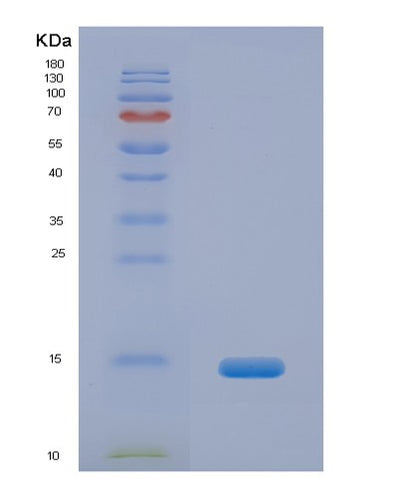 SDS-PAGE analysis of Human GLG1 (Golgi Apparatus Protein 1) - Recombinant Protein, CAT# BLT-07243P, showing >90% purity under 15% SDS-PAGE (Reduced)Human GLG1 (Golgi Apparatus Protein 1) - Recombinant Protein