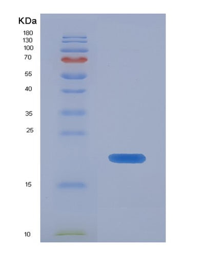 SDS-PAGE analysis of Mouse Fgf21 (Fibroblast Growth Factor 21) - Recombinant Protein, CAT# BLT-07244P, showing >90% purity under 15% SDS-PAGE (Reduced)Mouse Fgf21 (Fibroblast Growth Factor 21) - Recombinant Protein