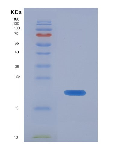 SDS-PAGE analysis of Mouse Fgf21 (Fibroblast Growth Factor 21) - Recombinant Protein, CATMouse Fgf21 (Fibroblast Growth Factor 21) - Recombinant Protein