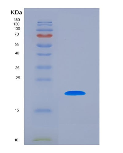 SDS-PAGE analysis of Human ACP3 (Prostatic Acid Phosphatase) - Recombinant Protein, CAT# BLT-07248P, showing >90% purity under 15% SDS-PAGE (Reduced)Human ACP3 (Prostatic Acid Phosphatase) - Recombinant Protein