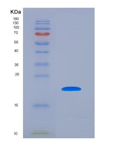 SDS-PAGE analysis of Human ACP3 (Prostatic Acid Phosphatase) - Recombinant Protein, CATHuman ACP3 (Prostatic Acid Phosphatase) - Recombinant Protein